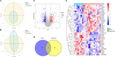 Identification of cellular senescence-related genes and immune cell infiltration characteristics in intervertebral disc degeneration